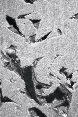 max-hornaecker-elmo-aluminium-contamination